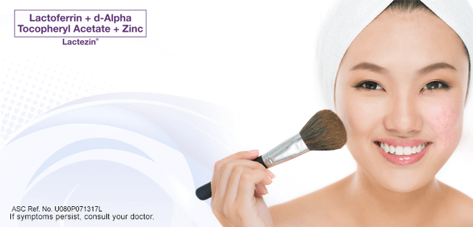best makeup products for acne-prone skin