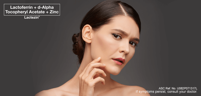 causes of acne in adult