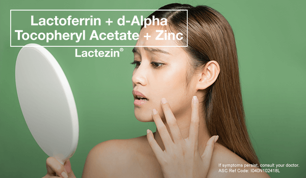 whiteheads vs blackheads