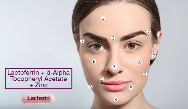 Pimple Care Tips Acne Face Map Understanding Pimples Their Locations On Your Face Lactezin