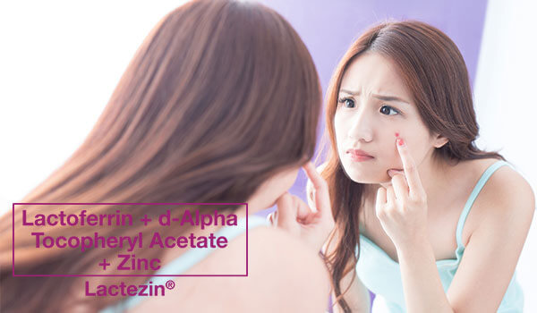 how-to-combat-hormonal-acne