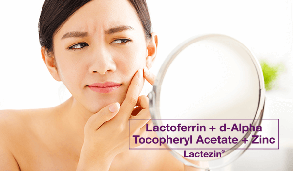lactezin-thumb-20200311-treating-acne