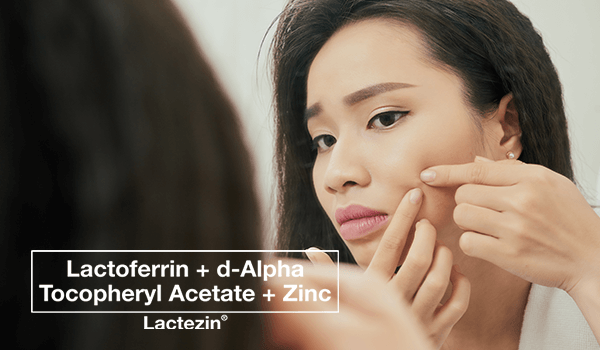 lactezin-thumb-20200311-why-acne-treatments-not-working