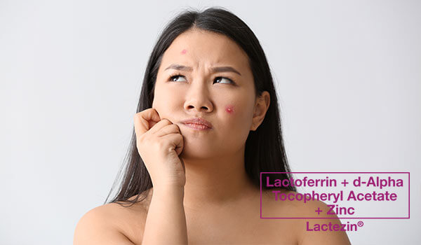 lactoferrin dosage for acne treatment