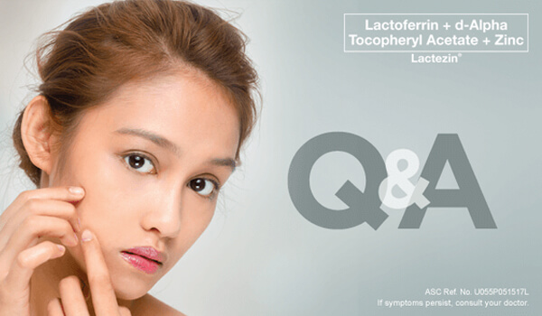 top question and answer about pimple care