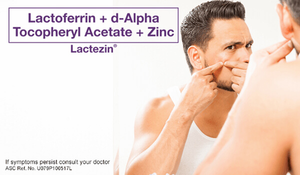 lactezin-article-stop-popping-your-zits-how-to-remove-pimples-safely